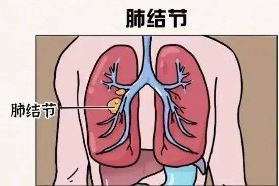 圖片3.png